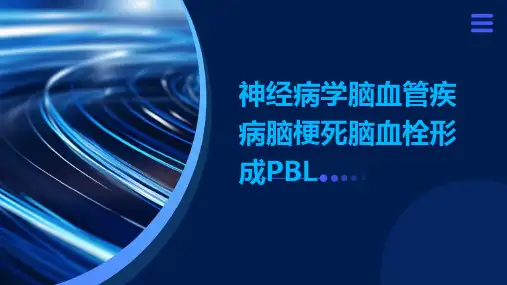 神经病学脑血管疾病脑梗死脑血栓形成PBLPPT