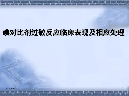 碘造影剂过敏反应临床表现抢救流程及相关处理ppt课件
