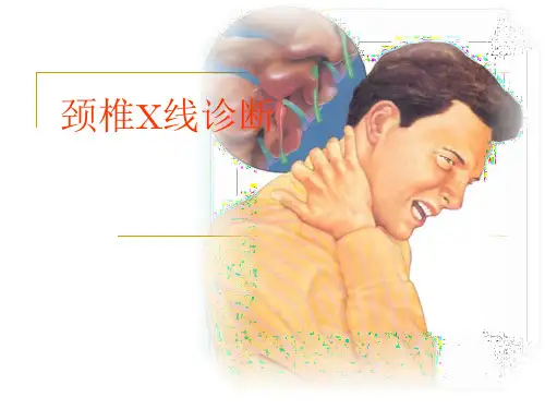 颈椎X线诊断-判断椎体退变