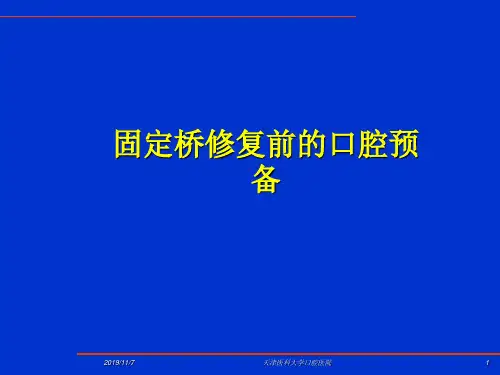 固定桥修复前口腔预备