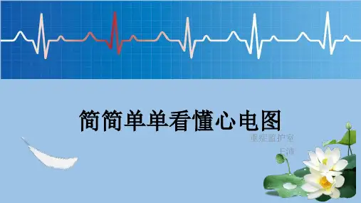教你看懂心电图ppt课件
