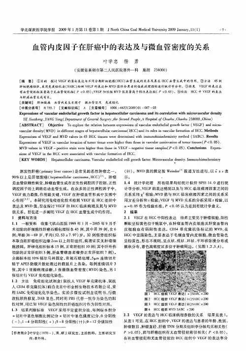 血管内皮因子在肝癌中的表达及与微血管密度的关系