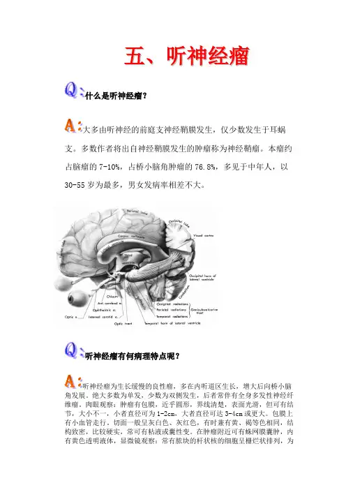 听神经瘤