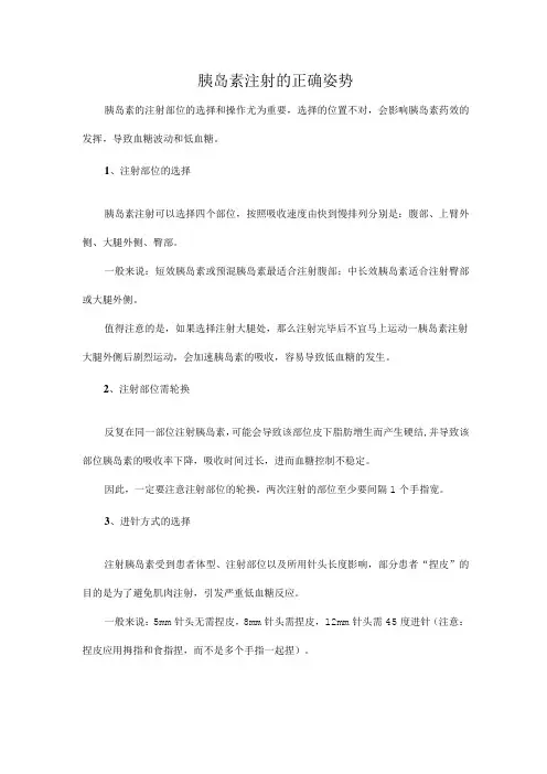 胰岛素注射的正确姿势