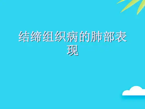 【正式版】结缔组织病的肺部表现PPT