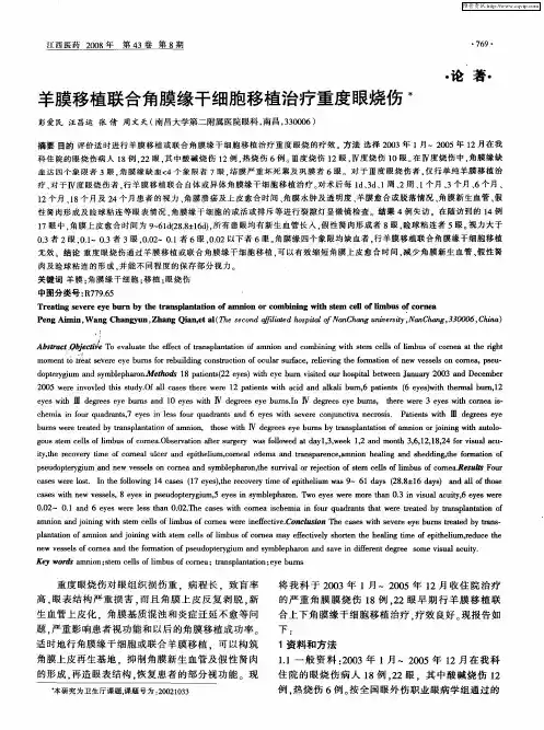 羊膜移植联合角膜缘干细胞移植治疗重度眼烧伤