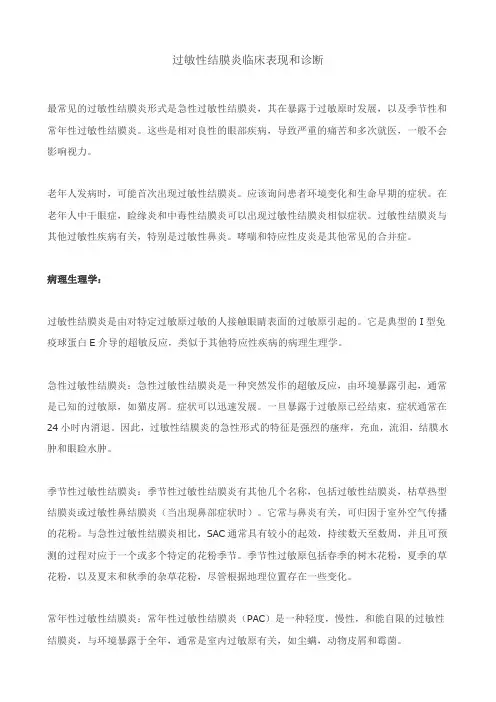 过敏性结膜炎临床表现和诊断