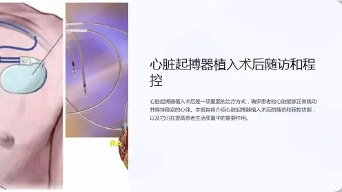 心脏起搏器植入术后随访和程控