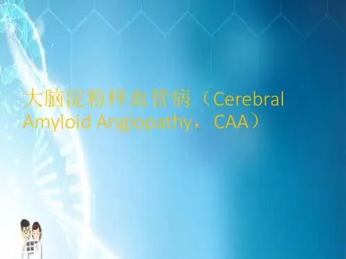 大脑淀粉样血管病PPT课件
