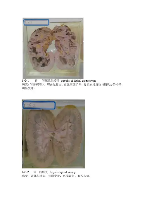 病理实验大体大体标本(完整)