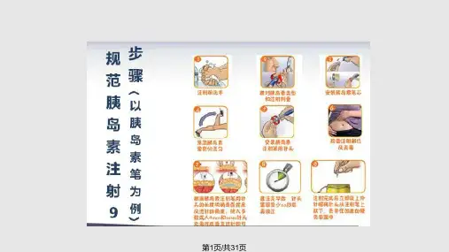 胰岛素规范注射PPT课件