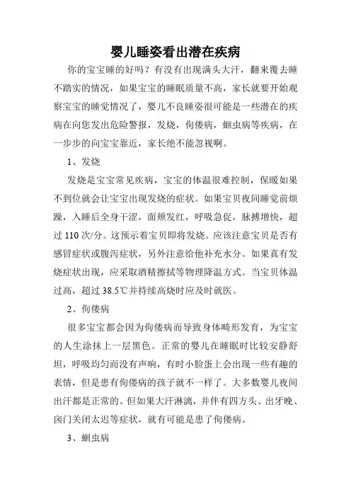 婴儿睡姿看出潜在疾病