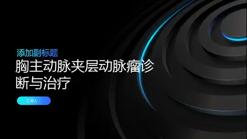 胸主动脉夹层动脉瘤诊断与治疗PPT