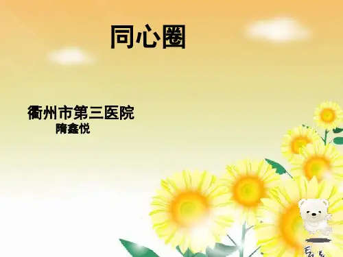 同心圈