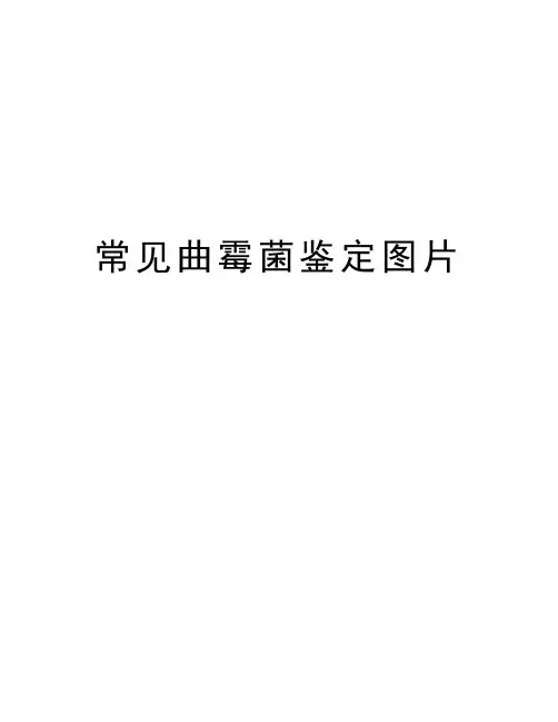 最新常见曲霉菌鉴定图片