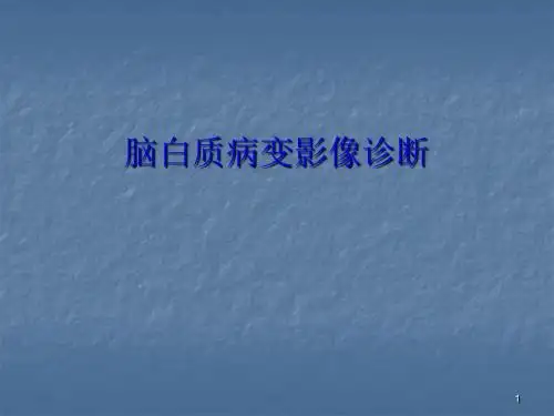 脑白质病变影像诊断ppt课件