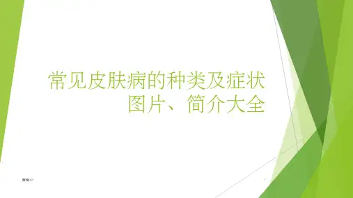 常见皮肤病的种类及症状图片简介大全