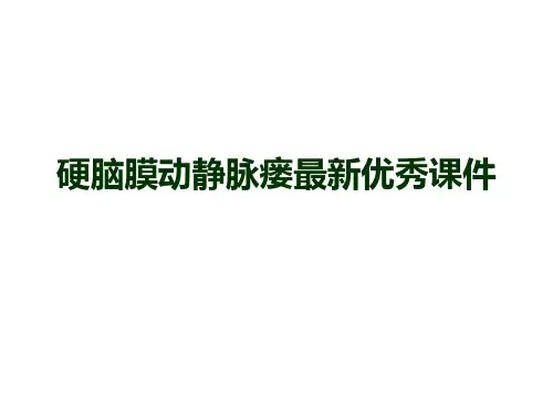 硬脑膜动静脉瘘最新优秀课件