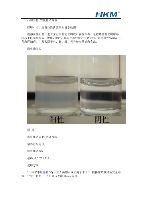 副溶血性弧菌的血清学检测