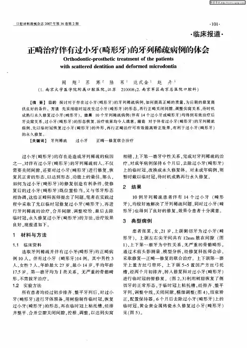 正畸治疗伴有过小牙(畸形牙)的牙列稀疏病例的体会