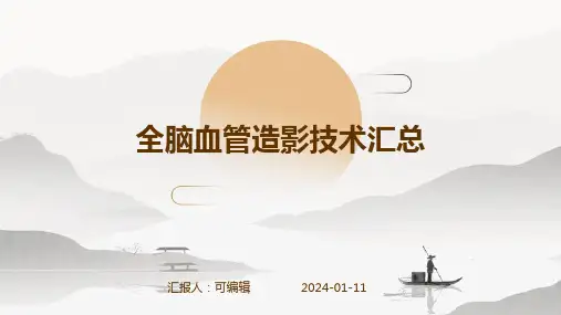 全脑血管造影技术汇总