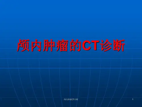 颅内肿瘤CT诊断ppt课件