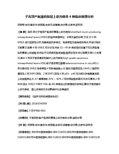 子宫颈产黏液的复层上皮内病变4例临床病理分析