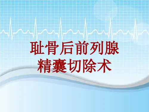 手术讲解模板：耻骨后前列腺精囊切除术