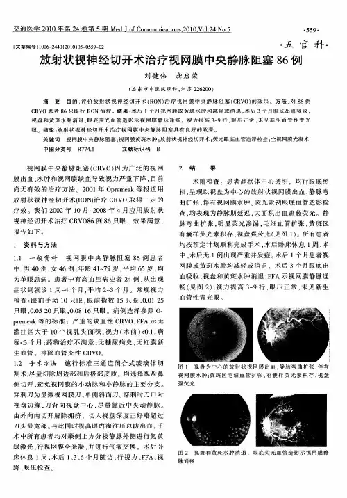 放射状视神经切开术治疗视网膜中央静脉阻塞86例