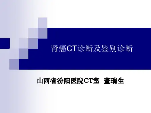肾癌诊断及鉴别PPT课件