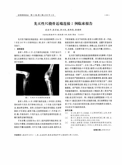 先天性尺桡骨近端连接2例临床报告