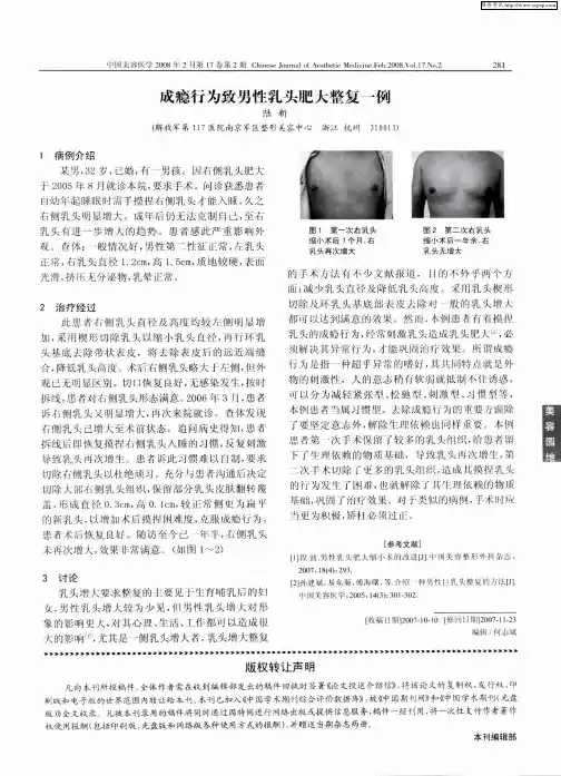 成瘾行为致男性乳头肥大整复一例