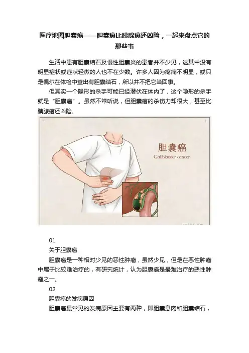 医疗地图胆囊癌——胆囊癌比胰腺癌还凶险，一起来盘点它的那些事