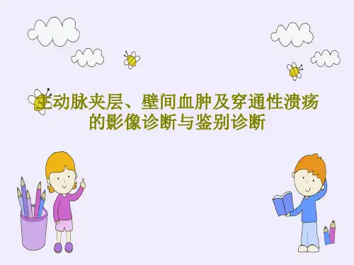 主动脉夹层、壁间血肿及穿通性溃疡的影像诊断与鉴别诊断PPT文档共72页