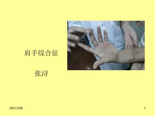 《肩手综合征》PPT课件