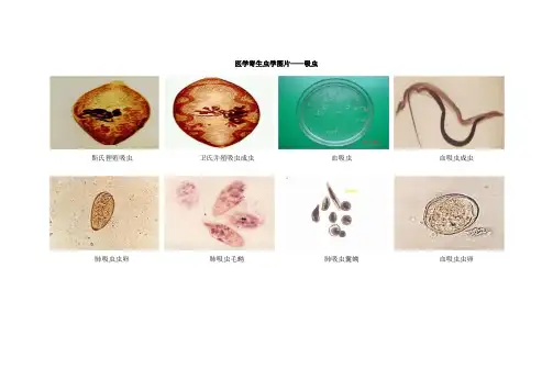 医学寄生虫学图片——吸虫