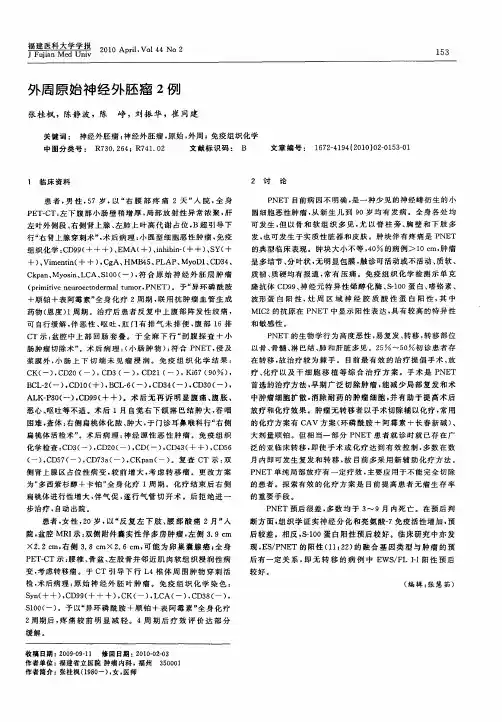外周原始神经外胚瘤2例