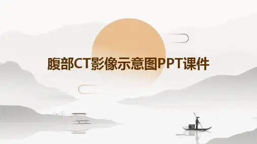 腹部CT影像示意图PPT课件