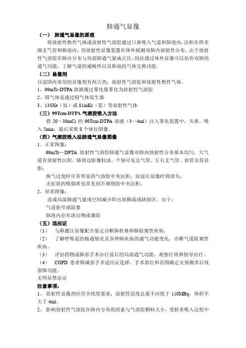 肺通气显像