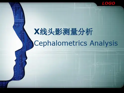 X线头影测量分析 (1)