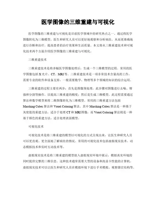 医学图像的三维重建与可视化