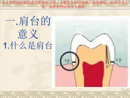 牙体制备时肩台的处置问题和注意事项培训课件