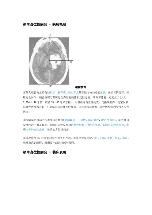 颅内占位性病变