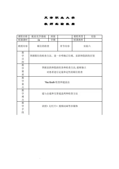 眼位检查