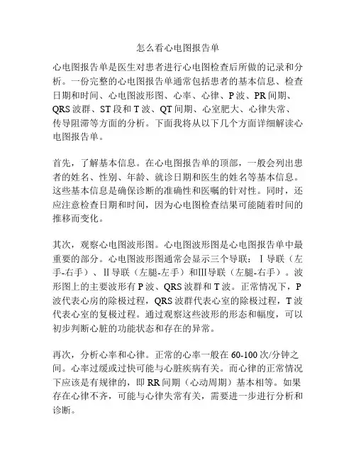 怎么看心电图报告单