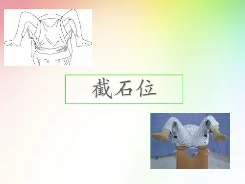 手术体位 截石位