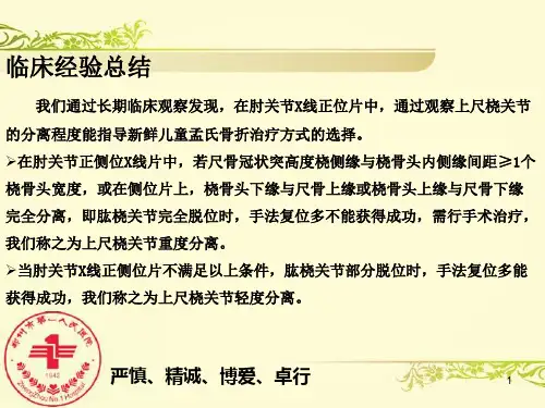 孟氏骨折 _2_2