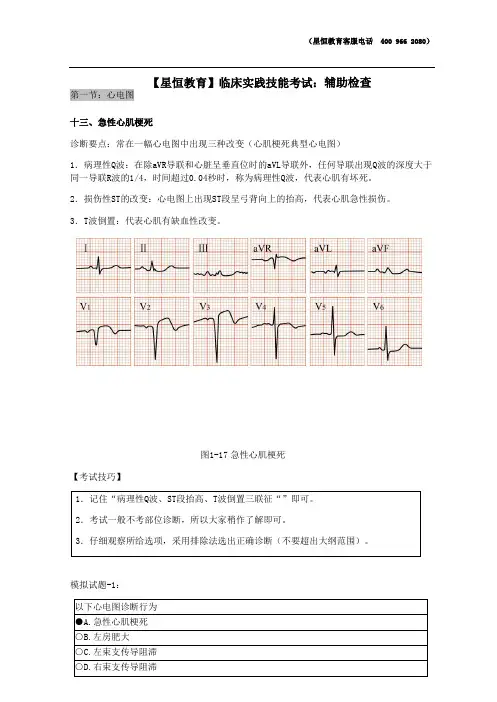 实践技能辅助检查之急性心肌梗死[临床实践技能考试]