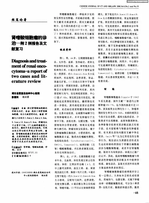 肾嗜酸细胞瘤的诊治——附2例报告及文献复习