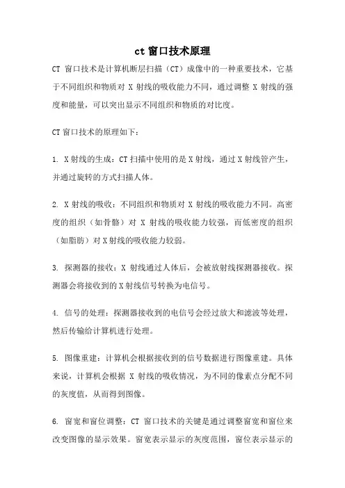 ct窗口技术原理